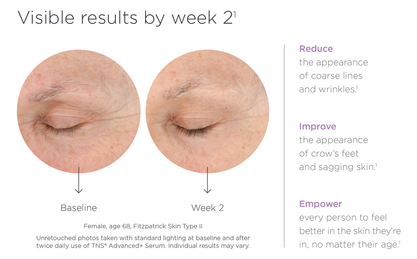 Skin Medica TNS Advanced+ Serum