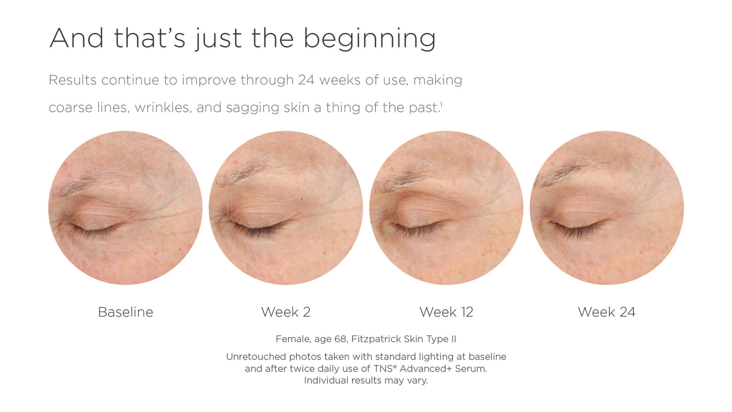 Skin Medica TNS Advanced+ Serum